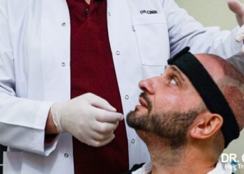 Hair Transplant In Istanbul: What You Should Know