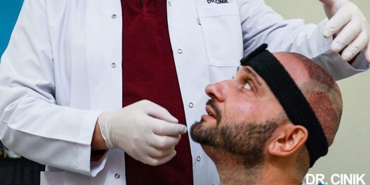 Hair Transplant In Istanbul: What You Should Know