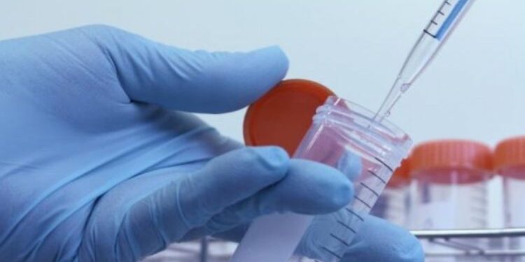 Avalo Therapeutics Inc (NASDAQ:AVTX) Shares Drop After Disappointing Earnings